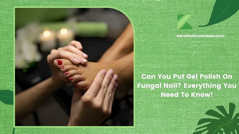 Can You Put Gel Polish On Fungal Nail? Everything You Need To Know!