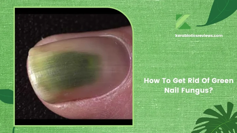 How To Get Rid Of Green Nail Fungus: Effective Strategies Unveiled!