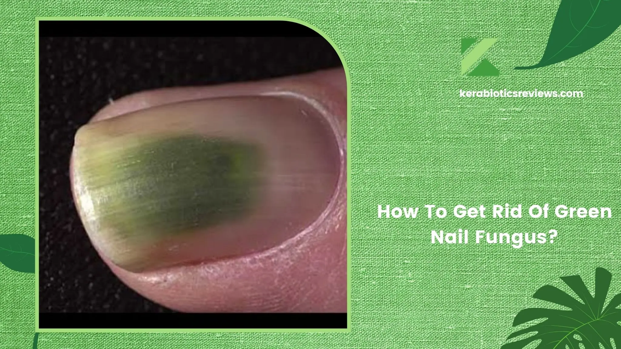 How To Get Rid Of Green Nail Fungus