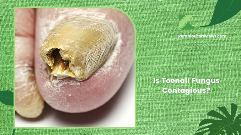 Is Toenail Fungus Contagious? Find Out The Truth!