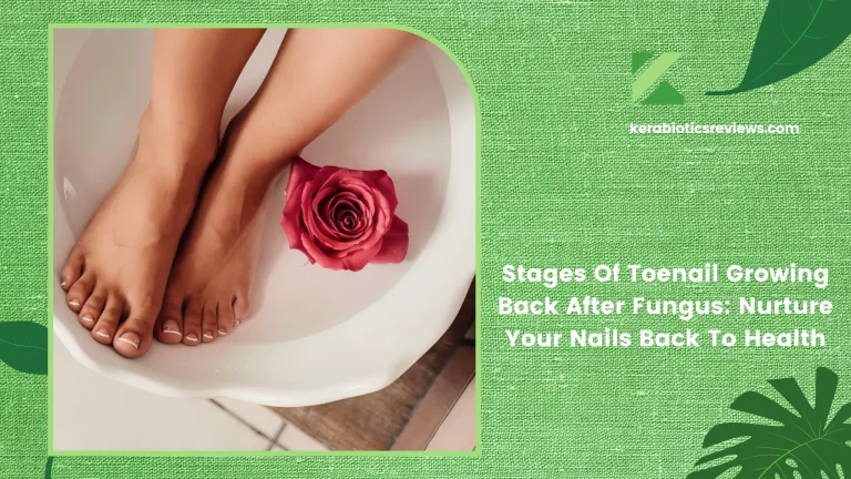 Stages Of Toenail Growing Back After Fungus: Nurture Your Nails Back To Health