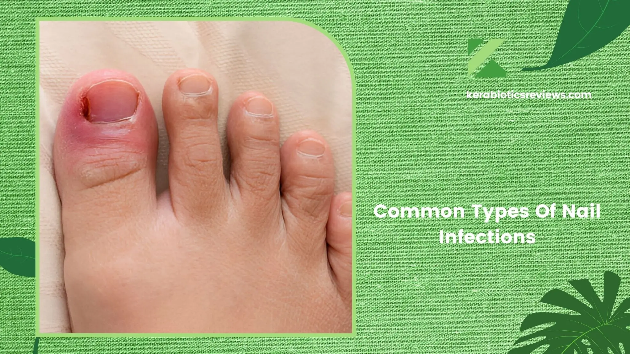 Types Of Nail Infections