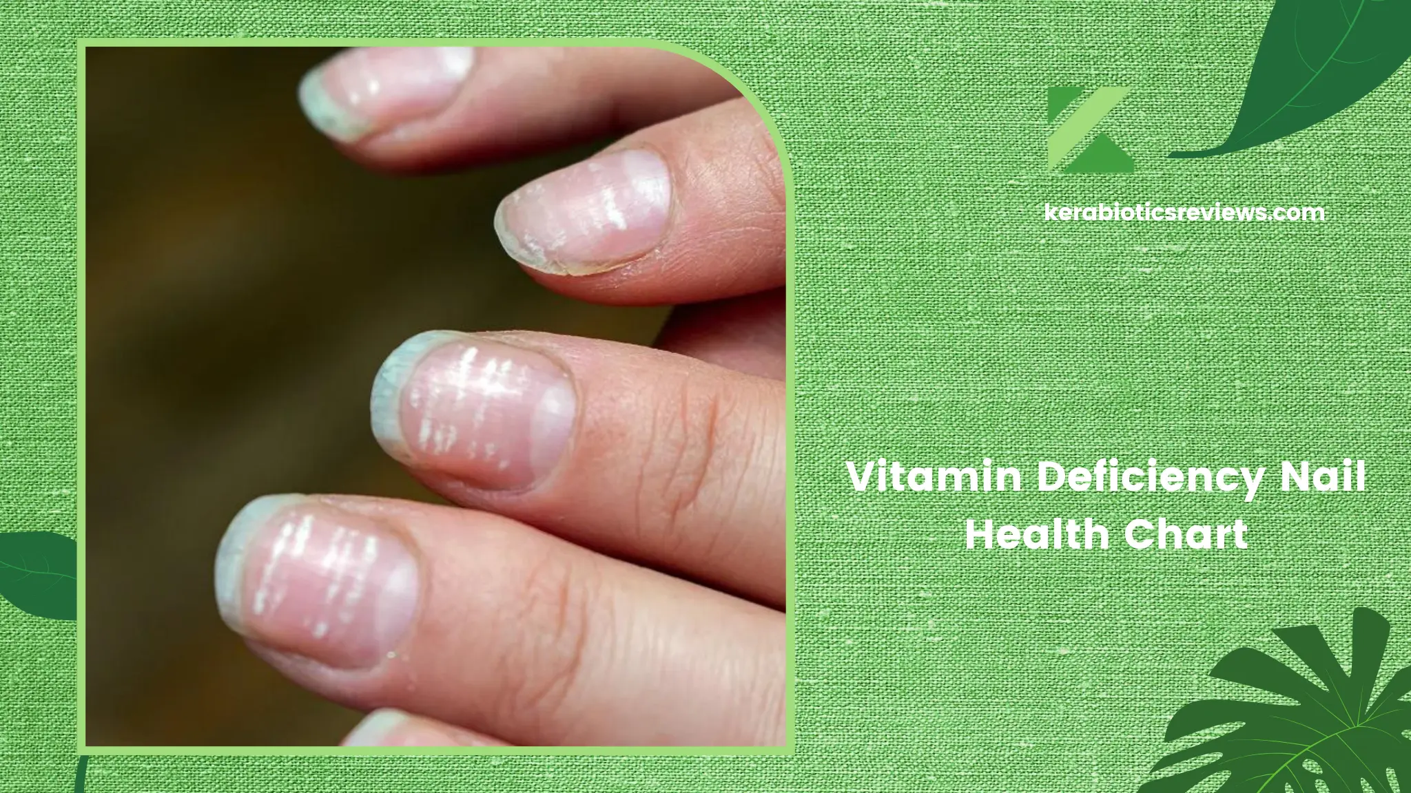 Vitamin Deficiency Nail Health Chart