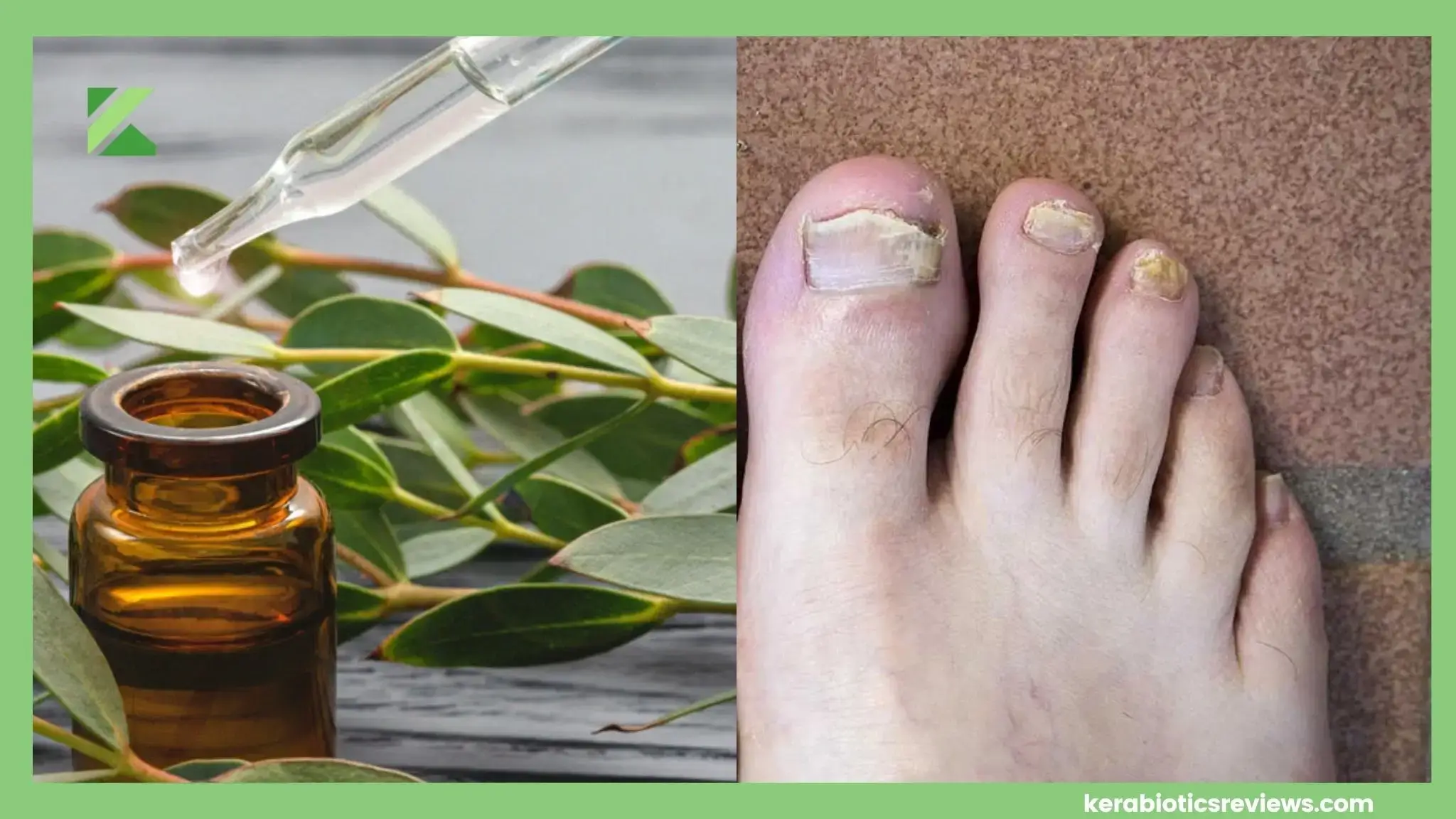 how to use eucalyptus oil for nail fungus